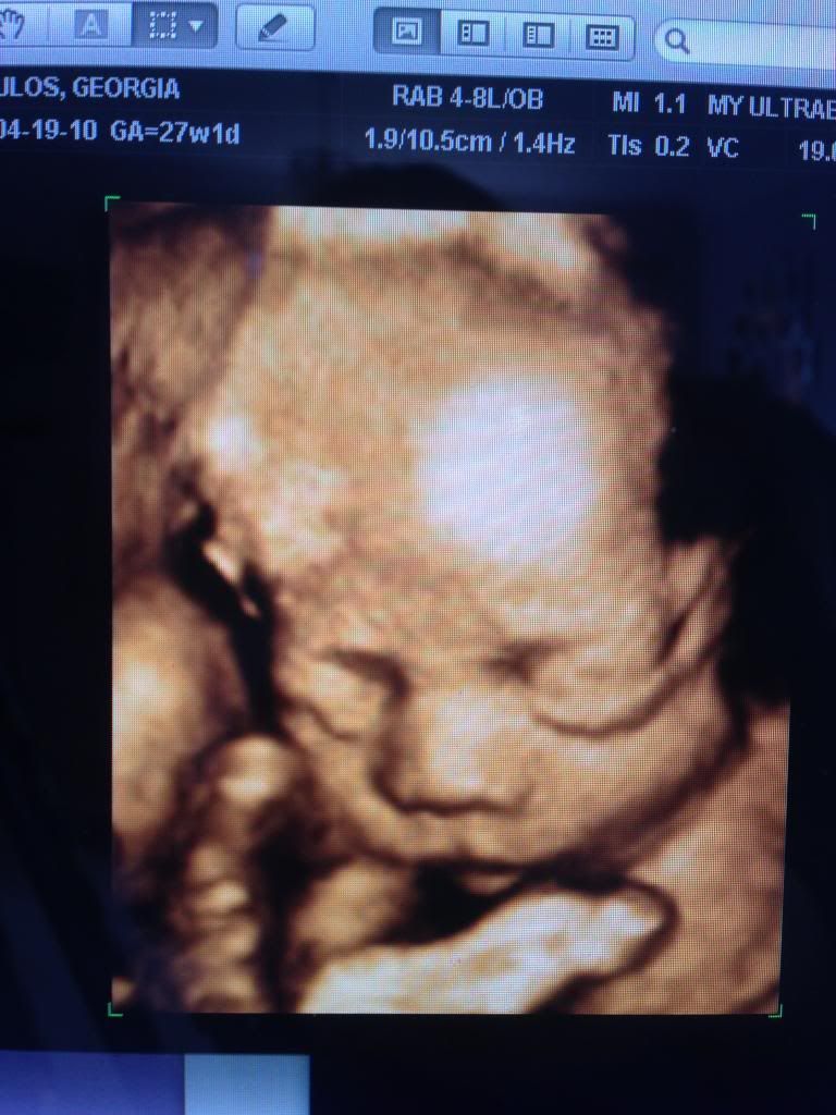 How much did your 3d scan look like baby (pic) BabyCentre