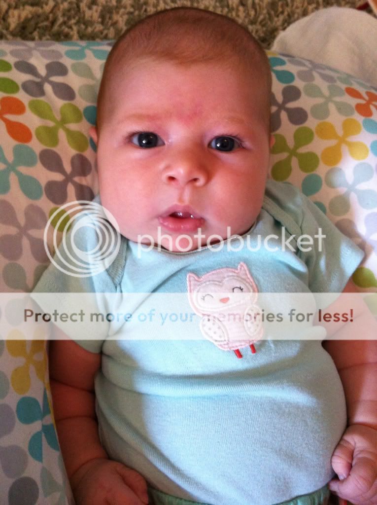 <em>Pic thread</em> Angel kisses/stork bites? BabyCenter